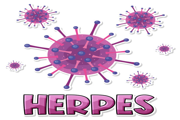 Herpes Simple Virus(HSV) on face and lips